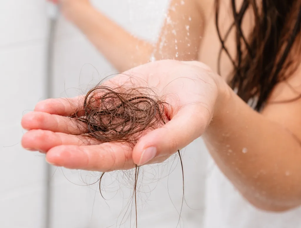 Cabello caído en la mano